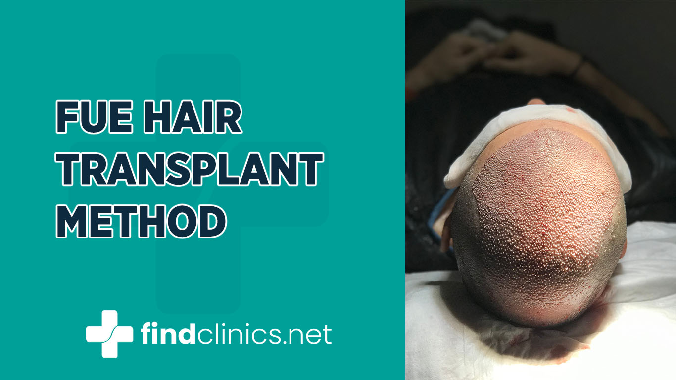 FUE Hair Transplant Method